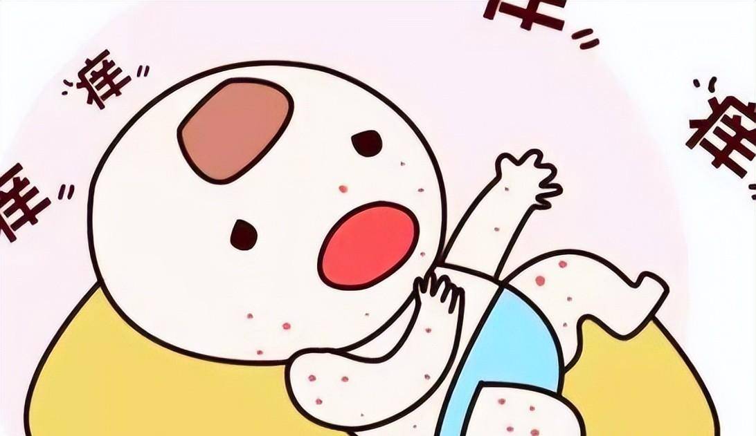 为什么会出痱子?出了痱子怎么办?怎么预防痱子?