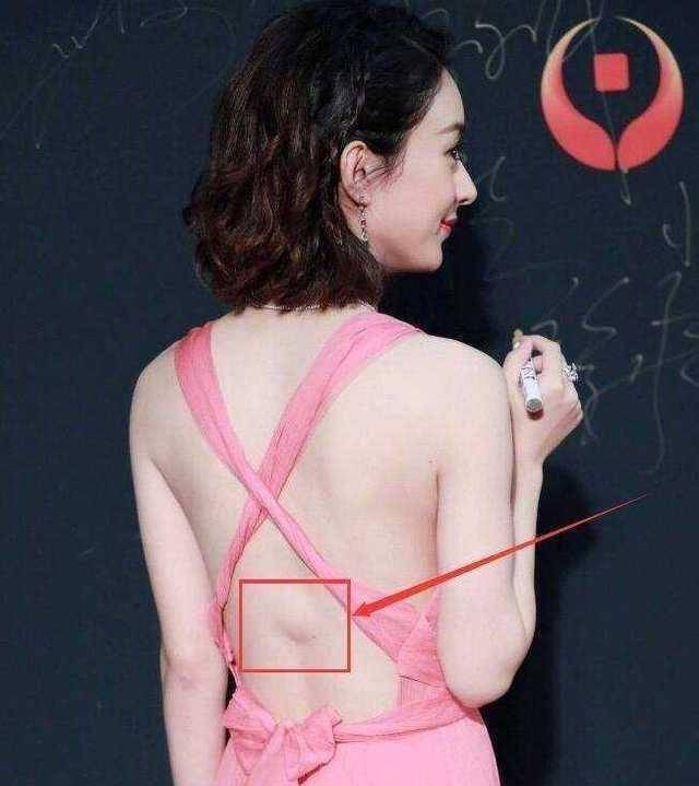 赵丽颖后背"长出一个肉包",而得知原因后,所有粉丝都沉默了!