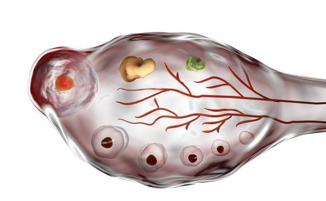 子宮腺肌症合併子宮腺肌瘤客戶分享_什麼_朋友_時候