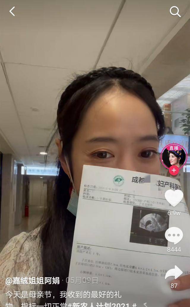 网红嘉绒姐姐阿娟晒二胎孕肚,穿高跟鞋在室内跳舞,大女儿才1岁_土特产