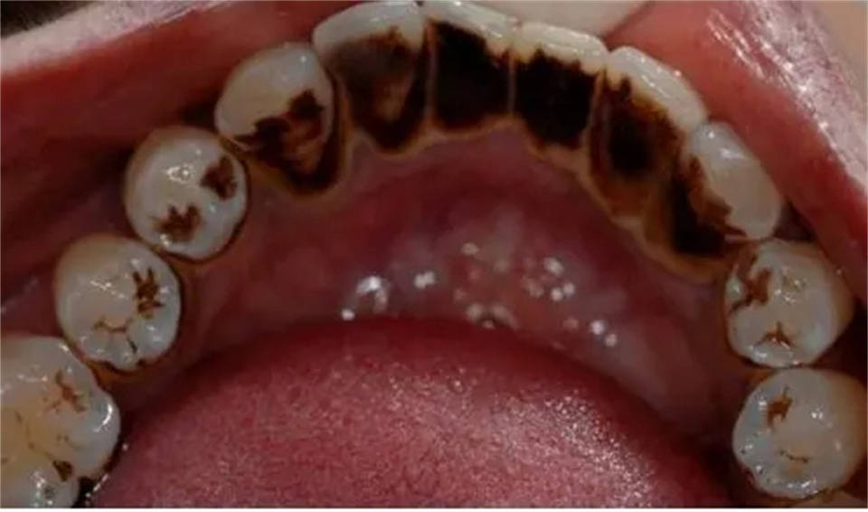 烟渍刷刷就能掉!_牙粉_牙齿_效果