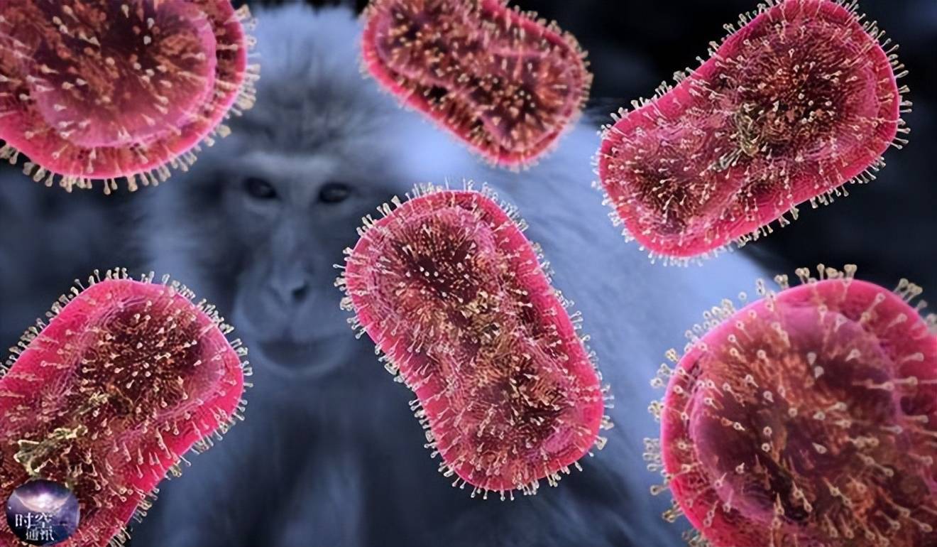 猴痘是什么传染病(猴痘的传染途径有哪些)