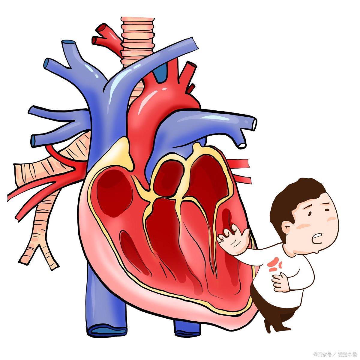 诺迪康胶囊:冠心病常识看这里!_因素_疾病_胸痛