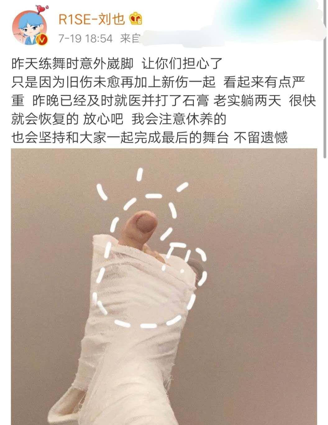 r1se刘也练舞意外崴脚,打石膏向粉丝报平安,还不忘卖萌_组合_受伤