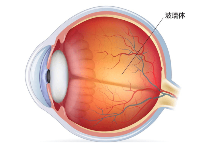 玉田中医院眼科玻璃体切除术病例展示