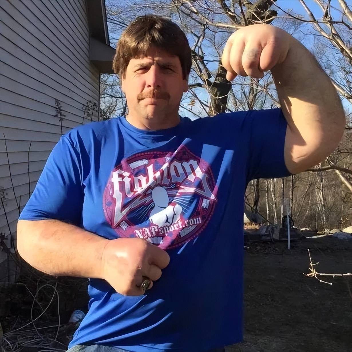 现实中的大力水手,有53厘米粗的大胳膊,医生说这不是病_杰夫达比_手臂