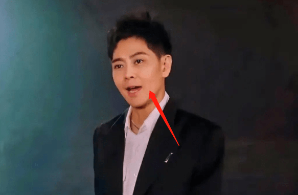 林志颖车祸后首亮相,脸部变形像ai,车祸后遗症严重差点半身不遂_哥哥