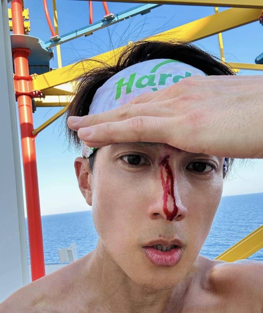 吴尊打篮球鼻梁受伤流血,先淡定拍照留念,在线求助自曝伤口很深_nei