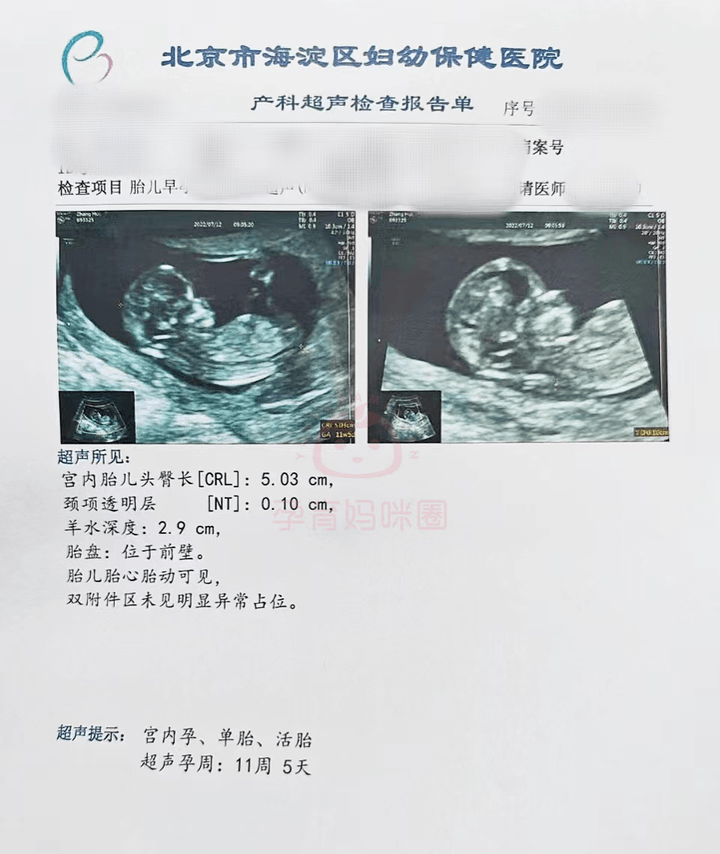 怀孕40周b超单子图片图片