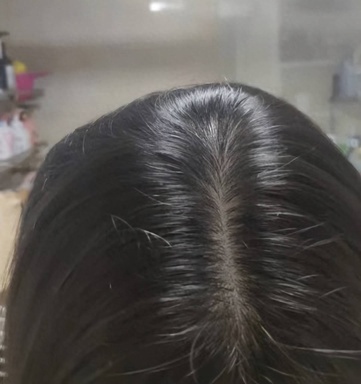 洗头_头皮_头发