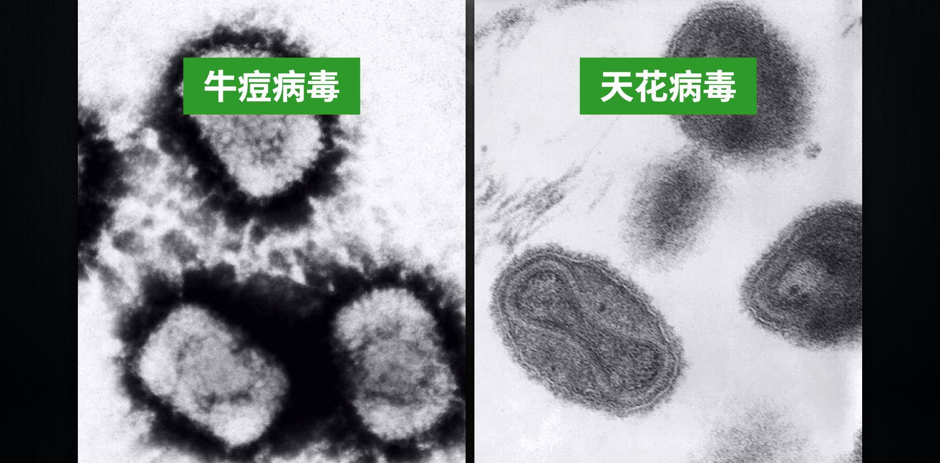 杀死5亿人的病毒,3000年人类束手无策,却被乡村医生的疫苗终结_顺治