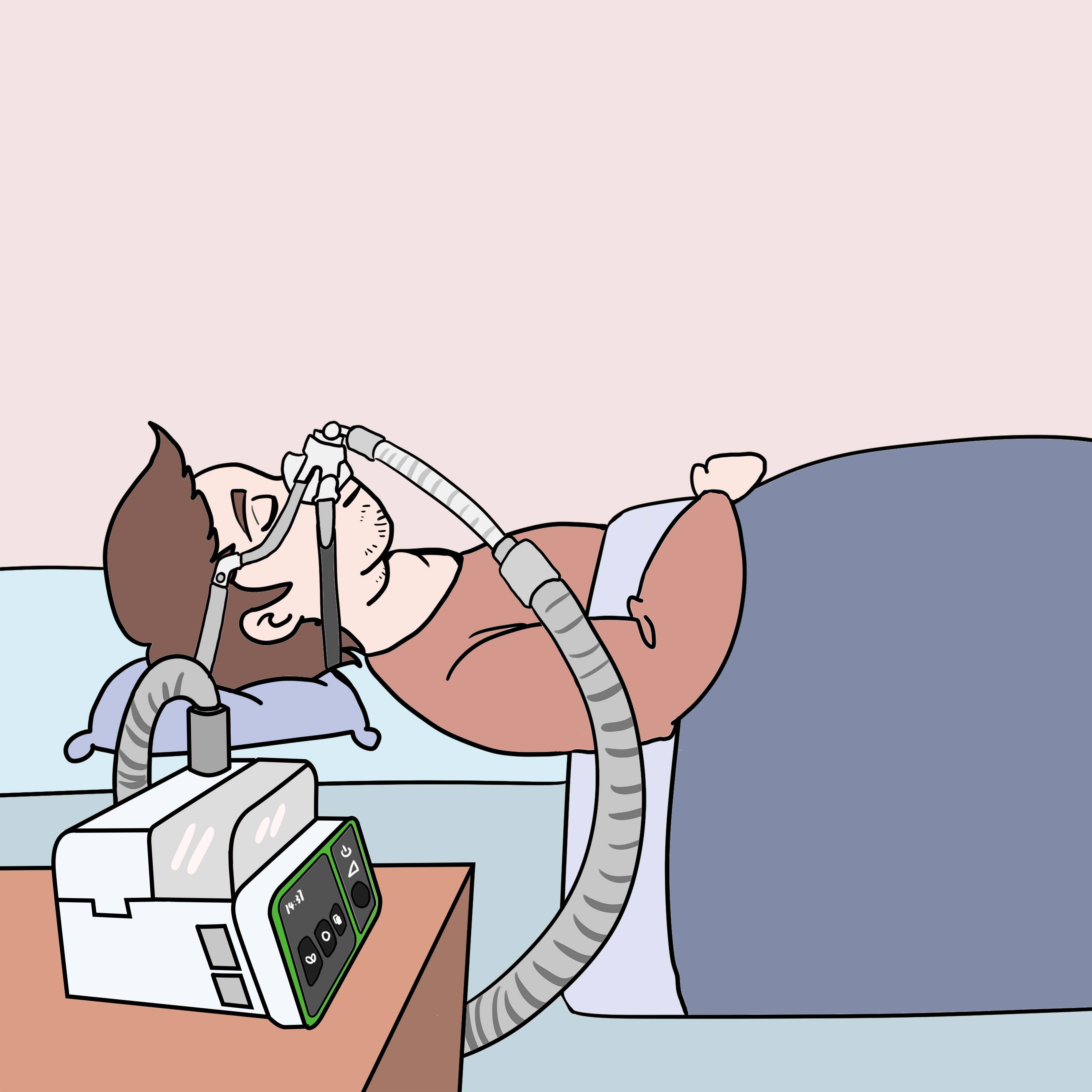 一台呼吸机到底贵不贵?_价格_保养_保修期