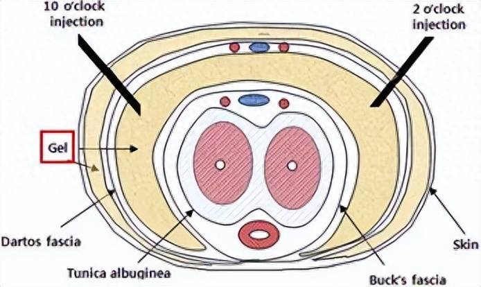 给丁丁打玻尿酸是什么演技操作?有群男人真这么干了_图片_来源_的项目