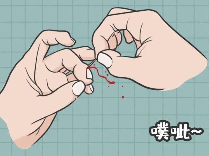 手上老是长倒刺该怎么办?预防倒刺我有妙招_皮肤_指甲_手部