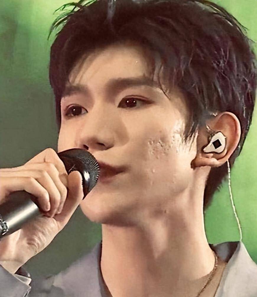 王源现身米兰探店,脸上坑坑洼洼全是痘印,生图精修差别大_外国人_网友