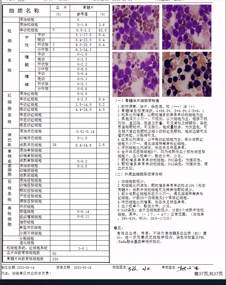 白血病血常规报告单图片