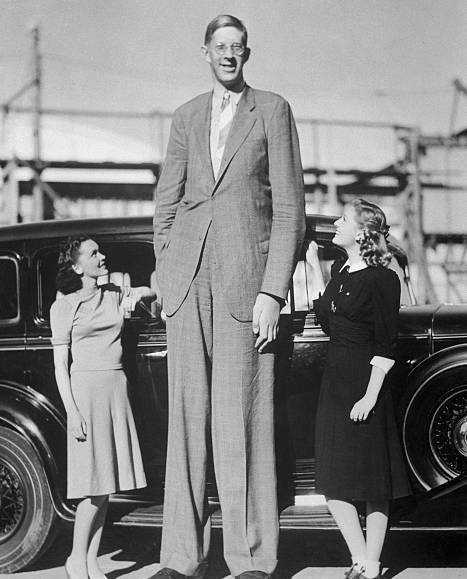 女巨人曾金莲,只活了18年,死后39年遗体仍未安葬_时候_个子_因为