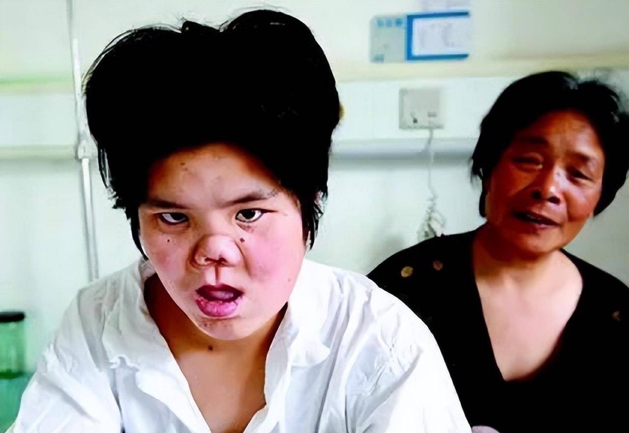 陕西农民捡到坑面女婴,哥哥做苦力为妹妹整容,变美后她嫁给哥哥_王娜