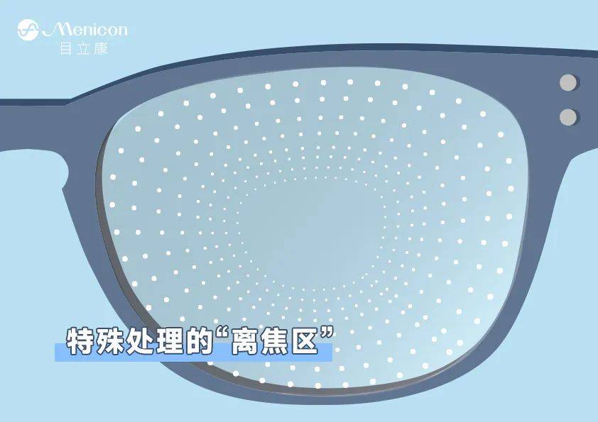 离焦框架眼镜和OK镜，区别是什么？应该怎么选？_防控_周边_孩子