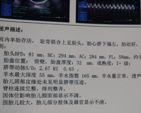 腹中是男宝还是女宝,不妨看b超单上的3个数据,或许有所收获