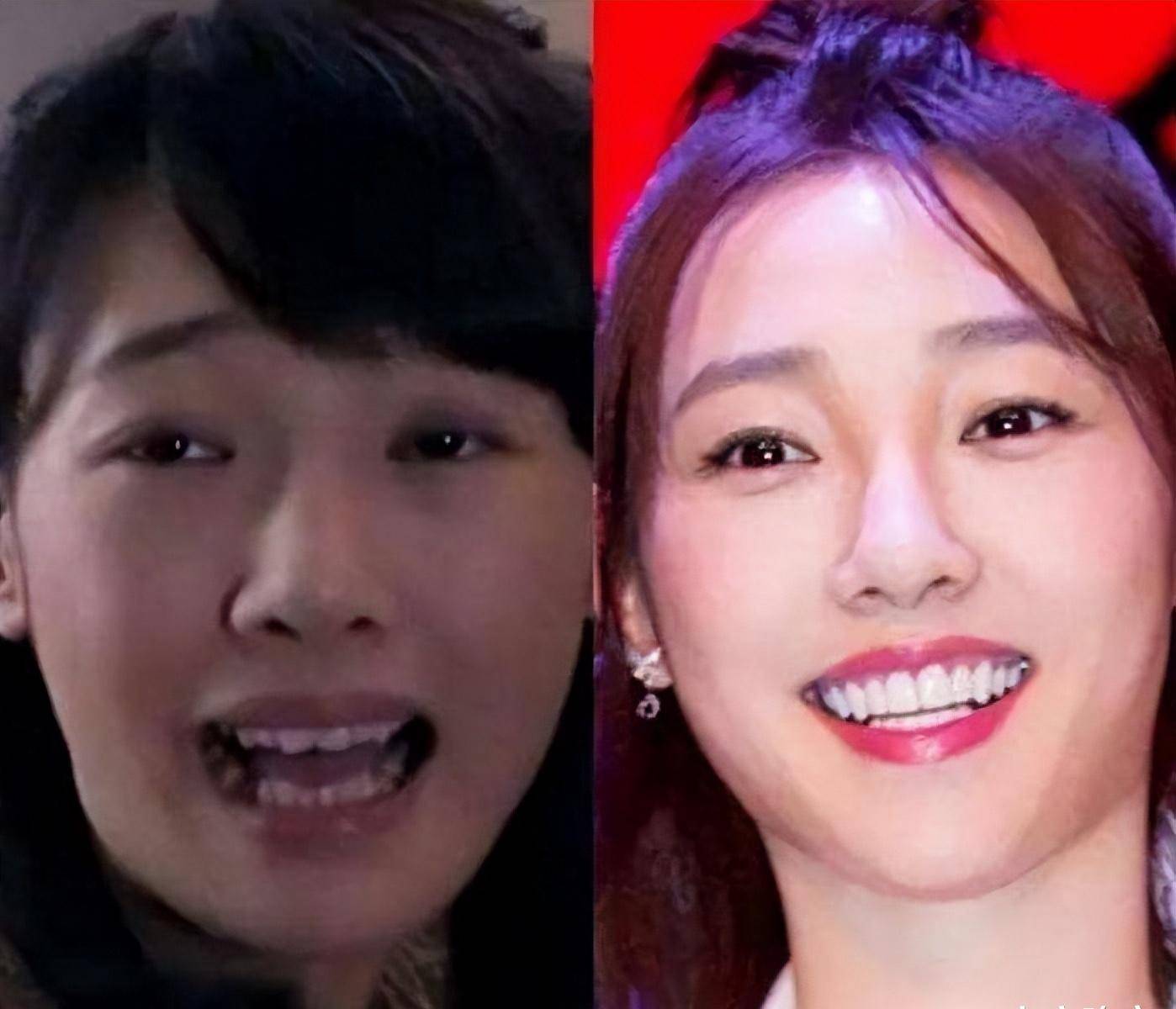 除了以上这几位,还有孔雪儿,白百何,古力娜扎,黄小蕾,孟非……原本很