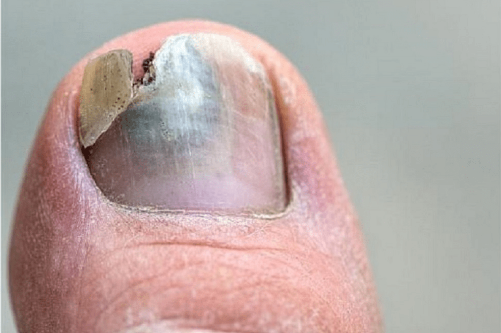 时候_时间_修甲