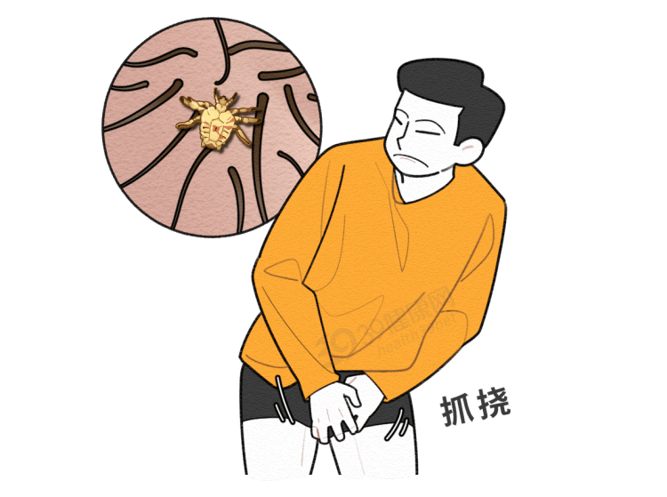 原来阴虱有3个传播途径_私处_治疗_繁殖