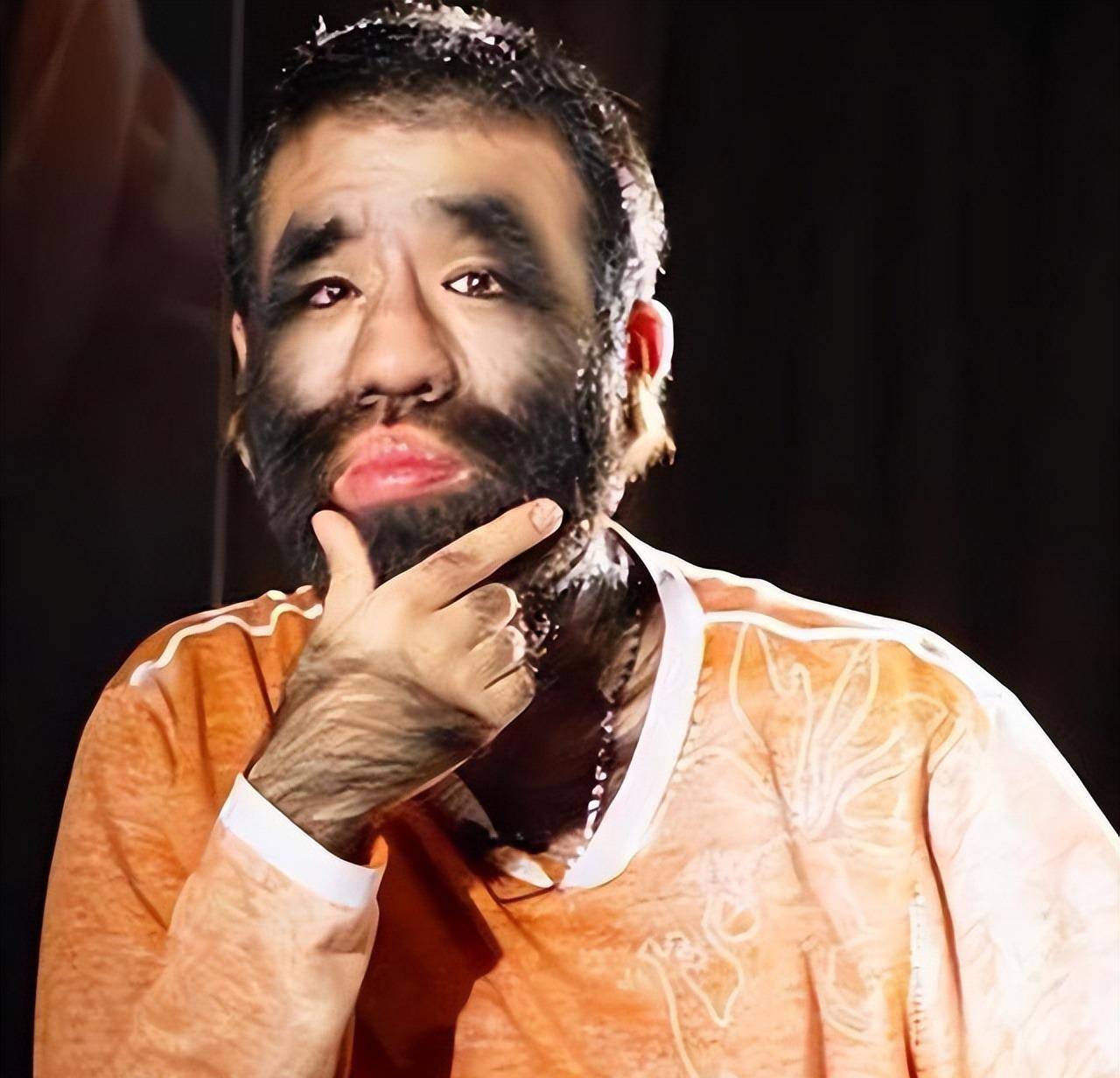 中国第一毛孩:为结婚被逼脱毛,42岁迎娶娇妻,儿子长啥样_于震寰_生活