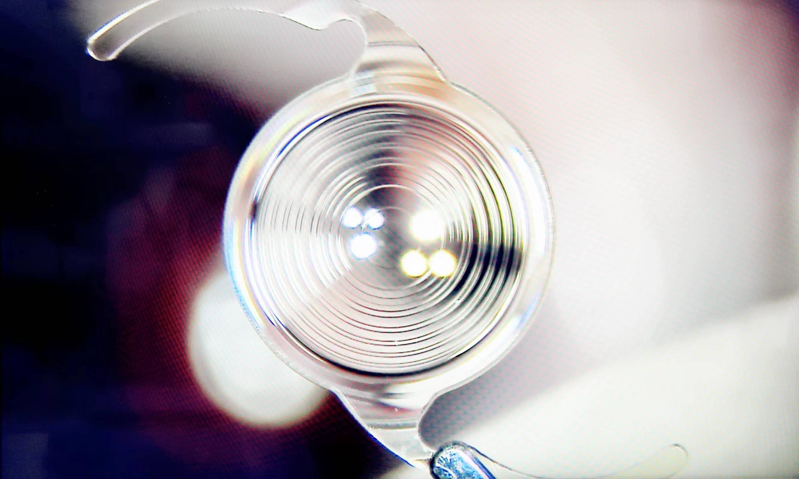 无极变焦晶体是一种连续视程人工晶体,与其他提供一个点或两三个点