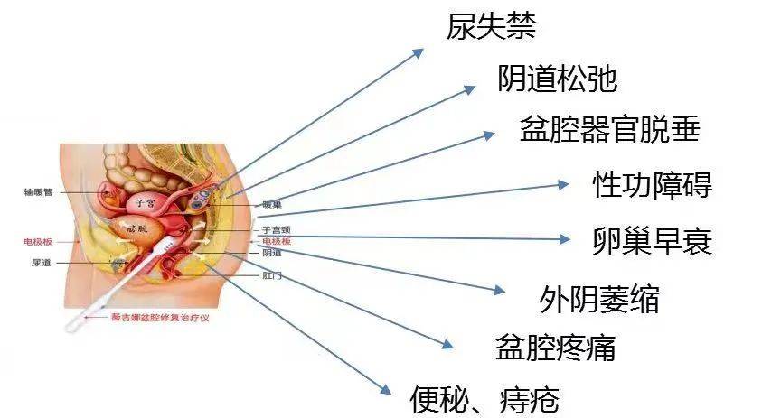 射频治疗让你变回紧致女性,成精致女人