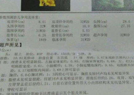 孕妇都需要到医院进行产检,特别是到了孕中期之后还会经常进行b超检查