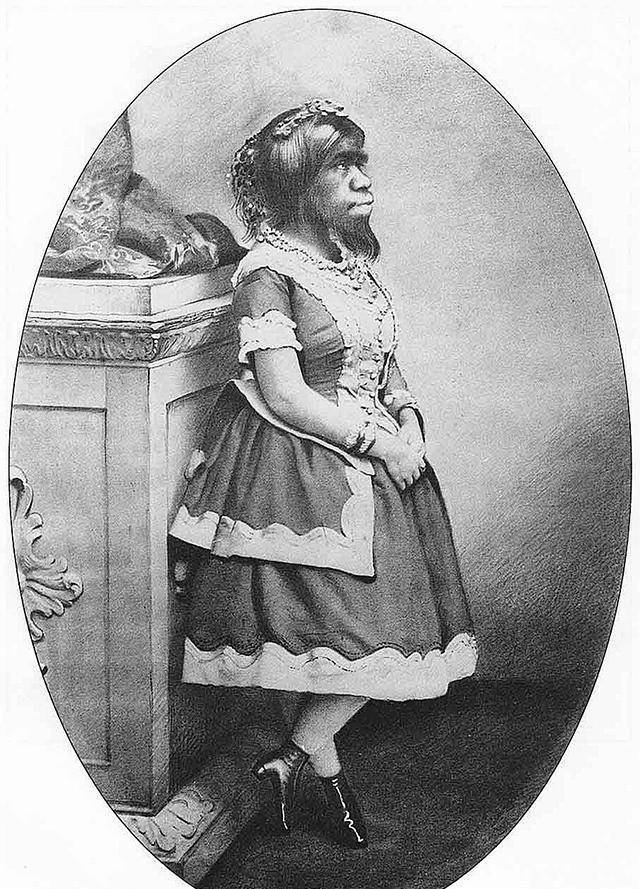 被称为最丑女人:拒20个求婚者,一生被当摇钱树,死后被制成标本_朱莉娅