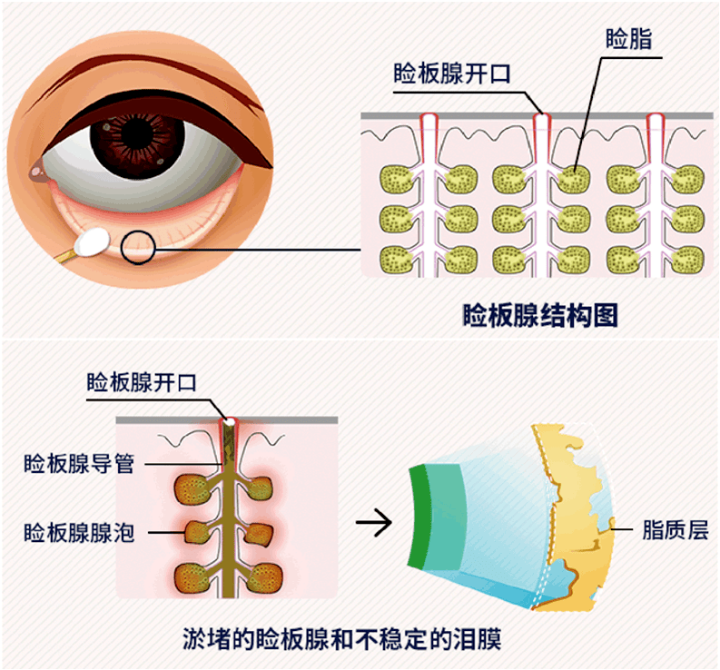 掐泪腺在哪怎么掐图片