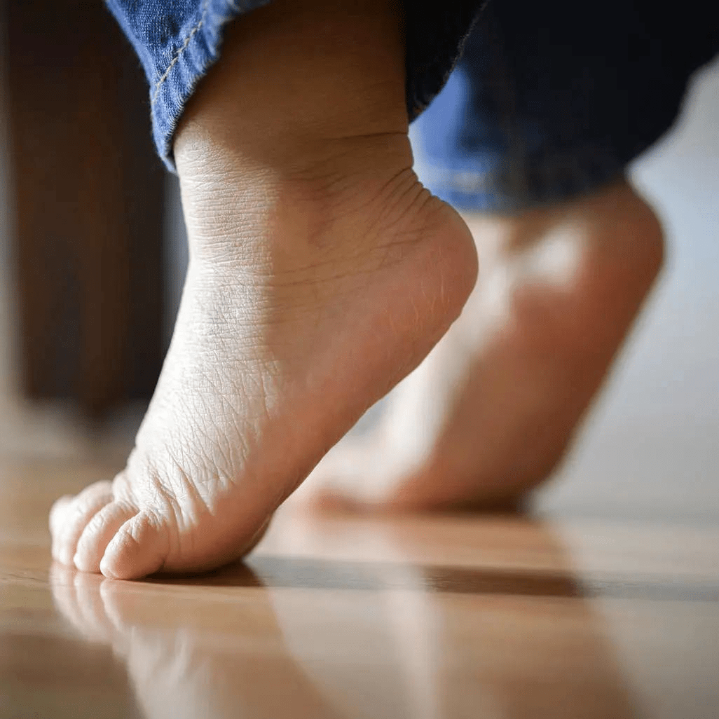 孩子踮脚走路就是自闭症吗?_肌肉_行走_脚尖