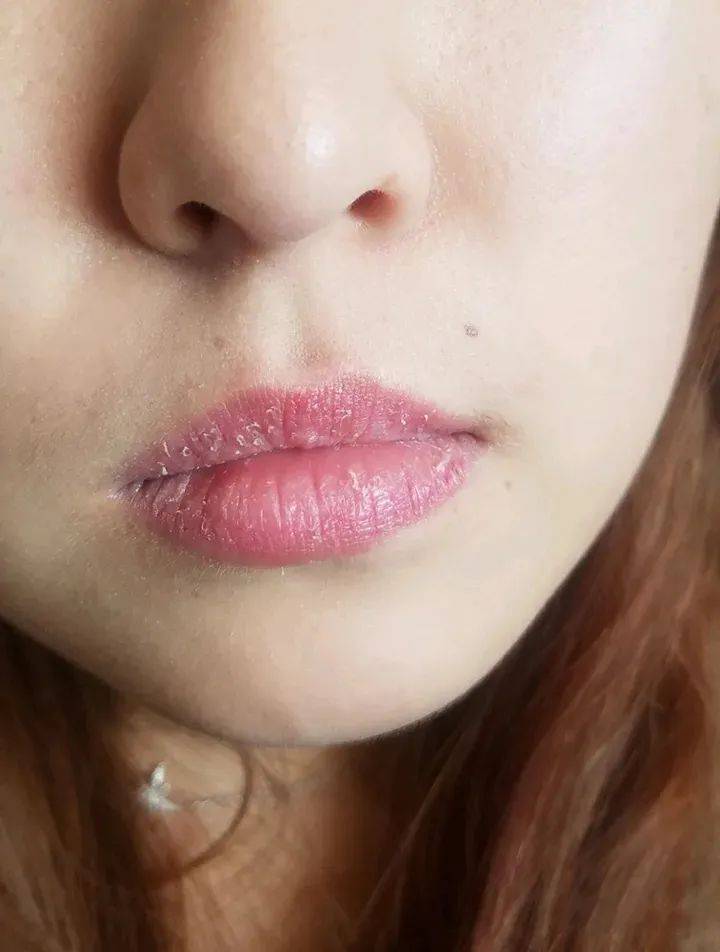 嘴唇起皮总当是缺水?跟体内津液有关!