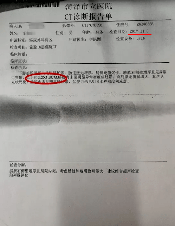 2017年11月份,80歲的車老無故反覆出現無痛尿血,引起了家人的重視