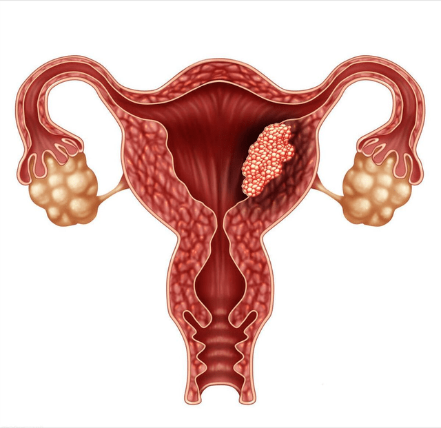 子宫内膜薄b超单图片图片
