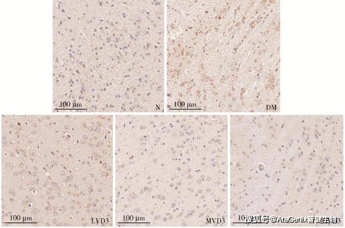 維生素d3對2型糖尿病小鼠輕度認知障礙的改善作用及機制研究_炎症