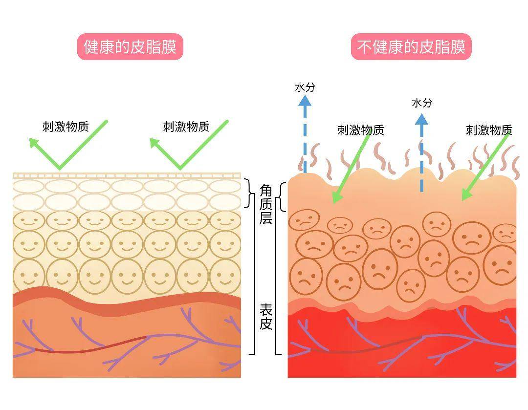 皮膚_表面_水分