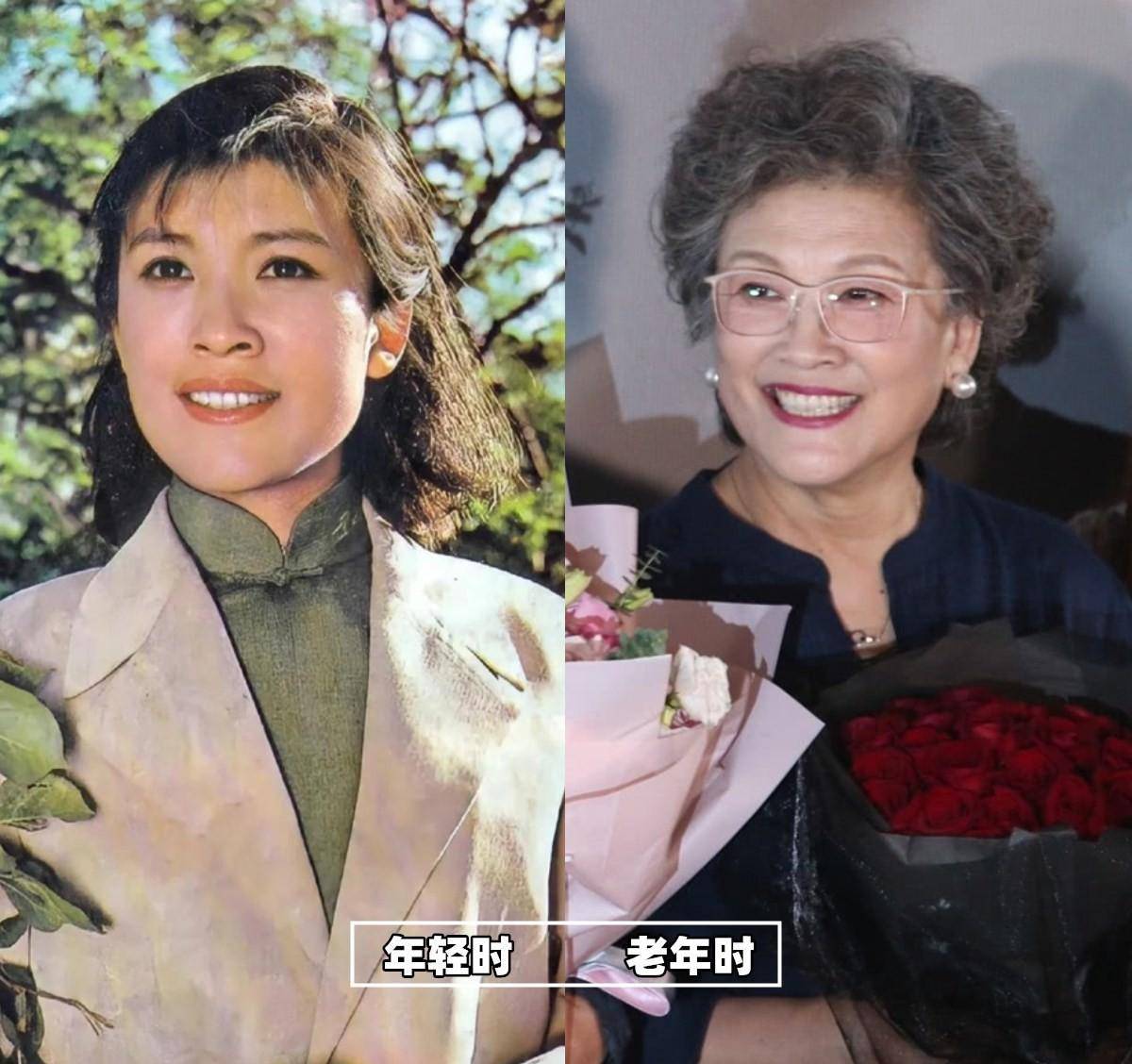 被72岁宋春丽老年状态惊艳:穿衣不扮嫩,满头白发照样优雅老去_头发