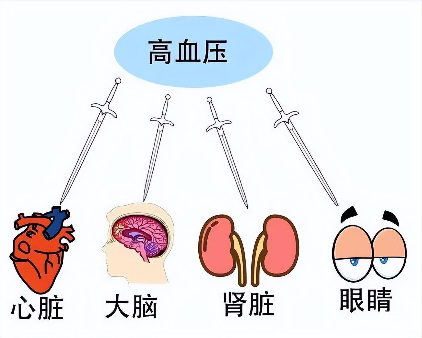 严重高血压出现6种并发症!医生提醒:做好6个预防!远离并发症