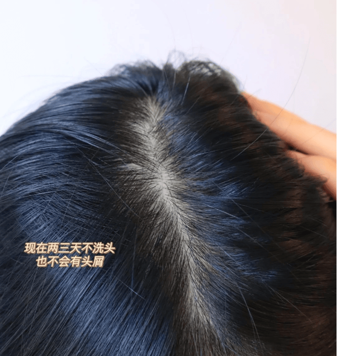 控油去屑止痒洗发水推荐?滋润洗发水推荐_头皮_问题_生活