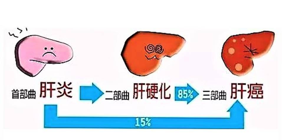 一医青年专家说科普76丨肝胆外科陈云志警惕乙肝悄悄向肝癌演变
