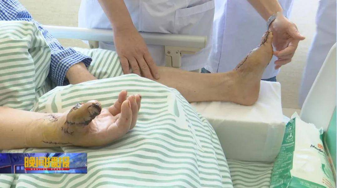 考虑到实用性和美观性,安医大一附院高新院区骨科主任周洪翔的团队