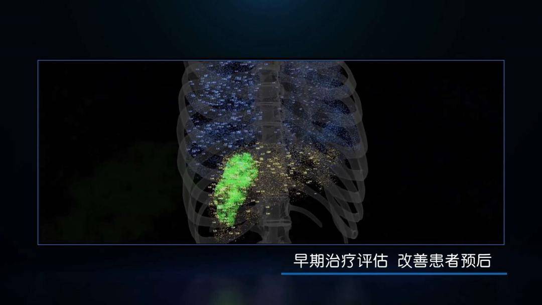 从模糊到清晰，GE发布全新一代ECT——NM/CT 860！-搜狐大视野-搜狐新闻