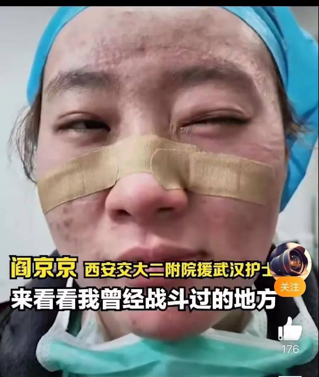 离开武汉后,30%的医护人员开始"病"了_疫情