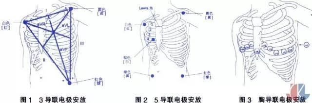 监护怎么连接示意图图片