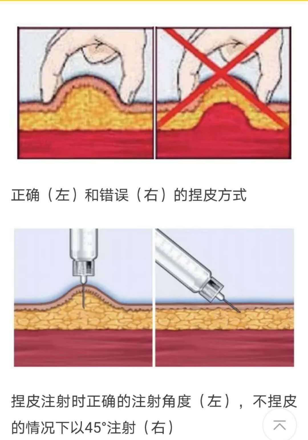 强弓仪器使用方法图片图片