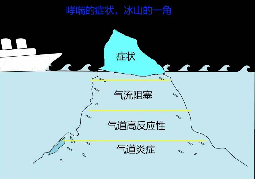儿童过敏性咳嗽只是哮喘的冰山一角一图了解过敏性哮喘