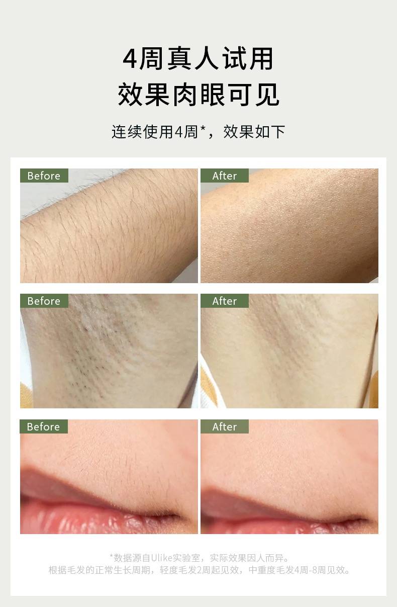 实验结果显示:被试者在正常使用ulike蓝宝石air冰点脱毛仪28天后,在